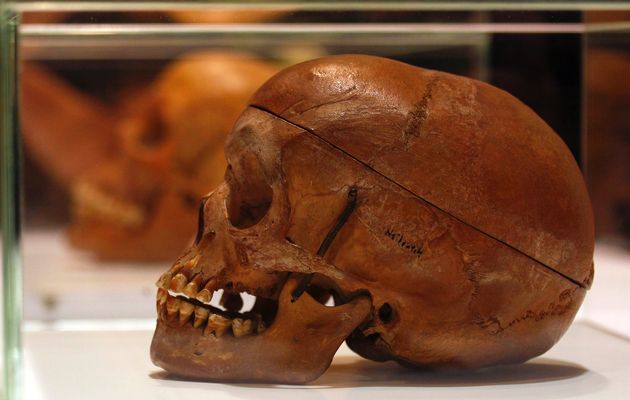 Herero women incarcerated in concentration camps in what was then German South-West Africa were given a terrible task: they were ordered to remove the flesh from the skulls of their dead menfolk. The skulls were stripped of soft tissue using boiling water and glass shards. They were then shipped to Germany for scientists to test the racial theories that were popular at the time. German troops had captured primarily members of the Herero ethnic group, but also some of the Nama. This human skulls was displayed at Berlin's Charite hospital. © Tobias Schwarz | Reuters 