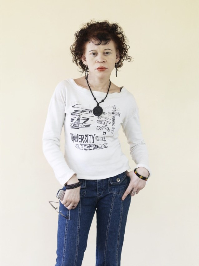 Sophia Mwhlammedi : 24 anos Já não se consegue perceber, de modo algum, se Sophia é branca ou preta, observou o fotógrafo. Mas é albina. Vive e trabalha nos escritórios da organização não governamental Under The Same Sun, em Dar-es-Salam. © Cortedia de | Courtesy of Patrick Gries